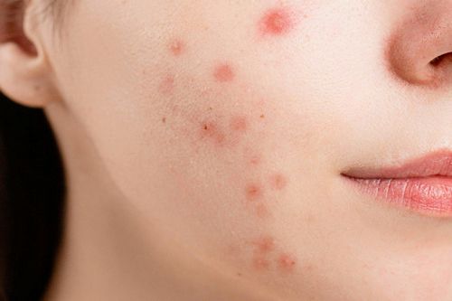 Dermatología clínica Valladolid Dermatología clínica Valladolid